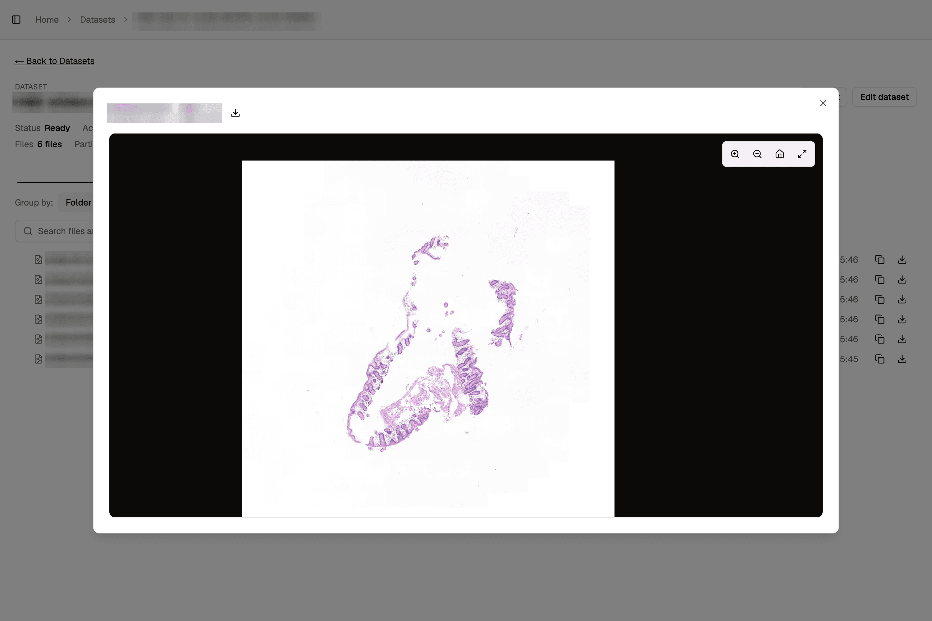 Whole-slide viewer open on an H&E slide, with zoom controls, over the dataset file list